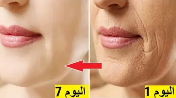 البوتكس السحري النشا والخميرة يخلصك من التجاعيد ويفتح البشرة في دقائق