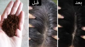 التخلص من شيب الشعر واستمتعي بمظهر صحي مع هذه الوصفات الطبيعية