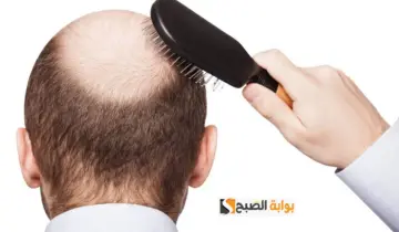 لو شعرك  تعالي.. هقولك على وصفة سحرية للقضاء على تساقط الشعر في اسبوع واحد