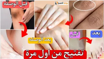 خلي ايدك بملمس الأطفال.. ماسكات طبيعية لتبيض اليدين والقدمين وإزالة التشققات نهائيا من اول استعمال
