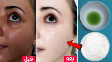 تبييض الوجه والجسم بالنشا