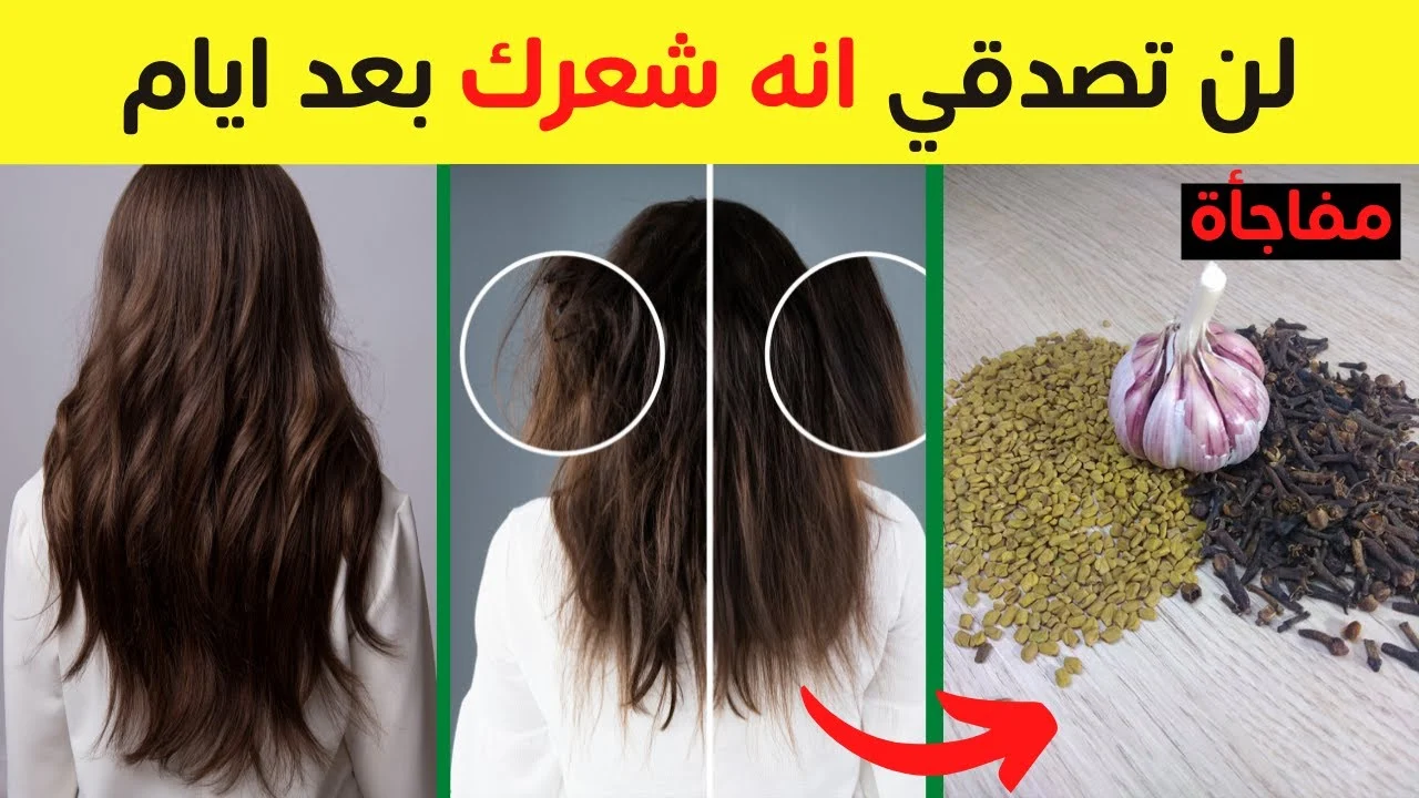 الكل هيسالك عليه.. وصفات جبارة لتطويل وتكثيف الشعر وابنات الفراغات جربية بنفسك وهتدعيلى