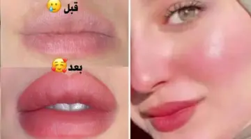خلطة توريد الخدود والشفايف