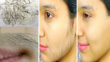 استعدي للعيد.. خلطة الليمون والعسل الرهيبة لإزالة شعر الوجه الزائد كله بدون ما تحسي بألم