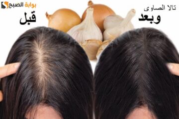 طريقة عمل زيت البصل والثوم لملء الفراغات وتطويل الشعر في وقت قصير