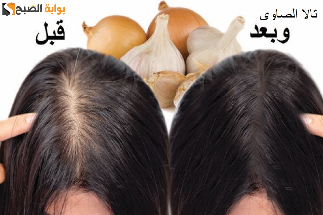 طريقة عمل زيت البصل والثوم لملء الفراغات وتطويل الشعر في وقت قصير 5 طريقة عمل زيت البصل والثوم لملء الفراغات وتطويل الشعر في وقت قصير