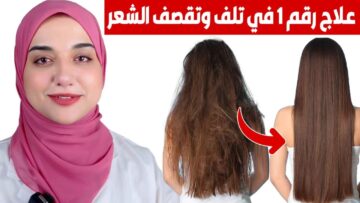 اتخلصي من جفاف الشعر نهائيًا.. طريقة ماسكات الألوفيرا لإطلاله ساحرة وشعر صحي