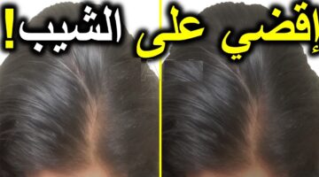 علاج الشيب بالخميرة