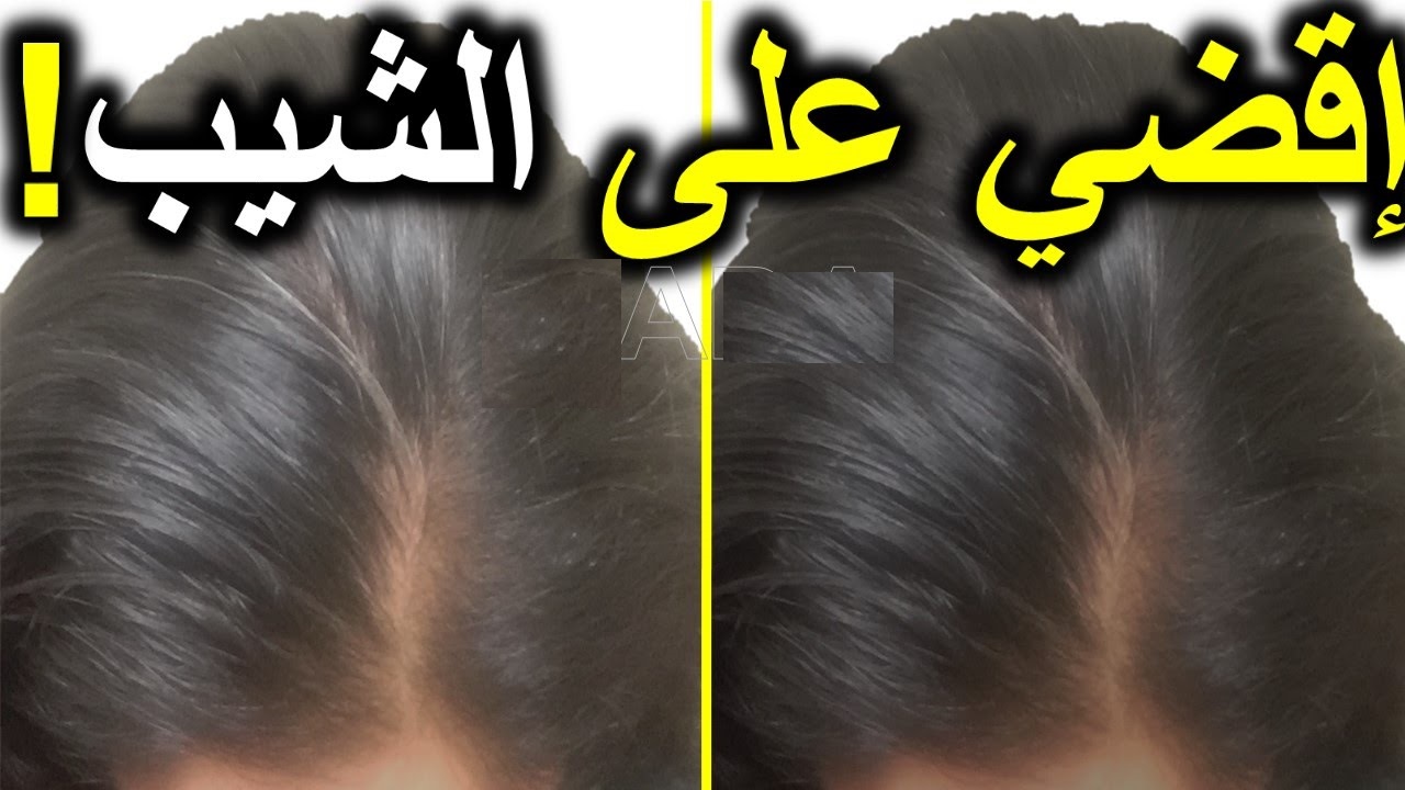 "بمكونات طبيعية" طرق التخلص من الشعر الأبيض والشيب نهائياً وبدون صبغات كيميائية 5 “بمكونات طبيعية” طرق التخلص من الشعر الأبيض والشيب نهائياً وبدون صبغات كيميائية
