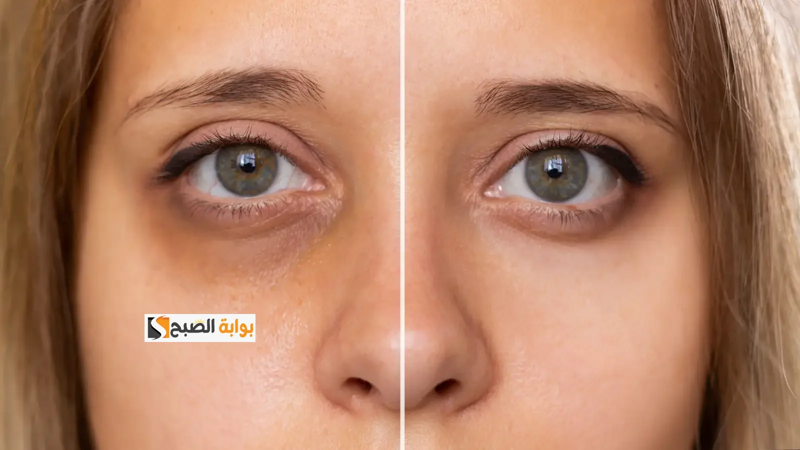عينيكي هتنور أحسن من الأول.. أفضل وصفات طبيعية لإزالة الهالات السوداء من أول يوم هتلاحظي النتيجة