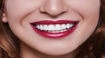 فوائد قشر الموز في تبييض الأسنان