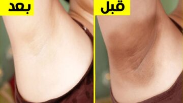 بأقل من 20 جنيها.. وصفة التخلص من رائحة العرق وتبييض منطقة الابطين والتخلص من السواد للابد