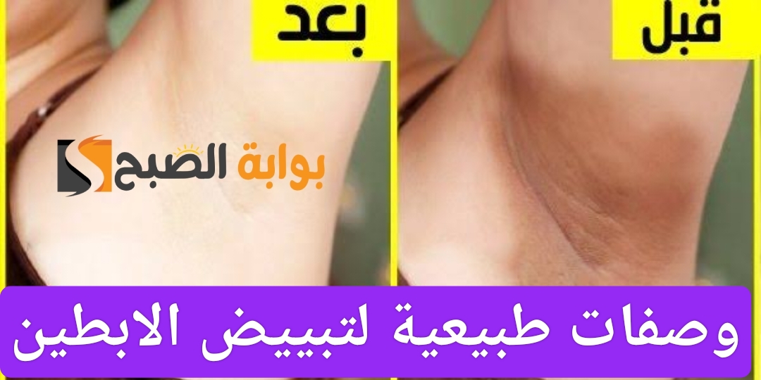 تخلصي من اسمرار الإبطين والمناطق الحساسة بوصفات طبيعية للتفتيح والترطيب والنعومة