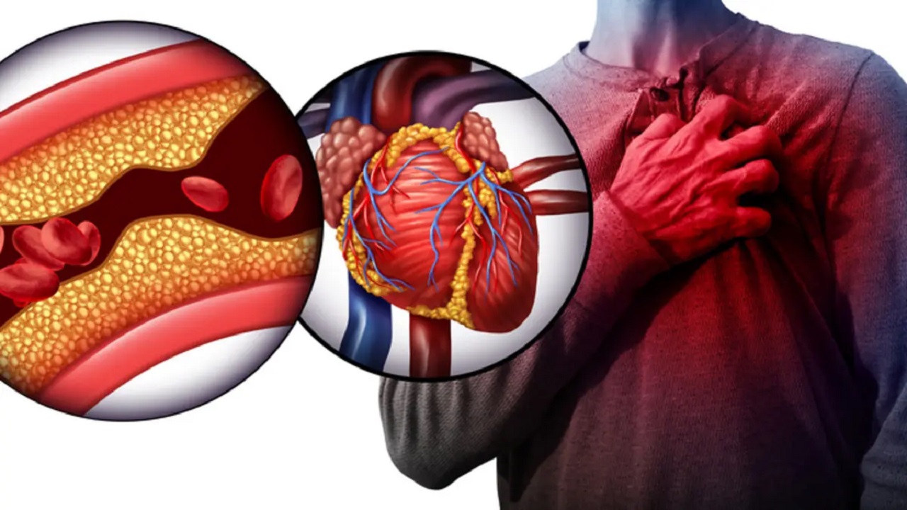 اكتشف الآن .. كيفية الوقاية والعلاج من ارتفاع الكوليسترول؟ وأسبابه 
