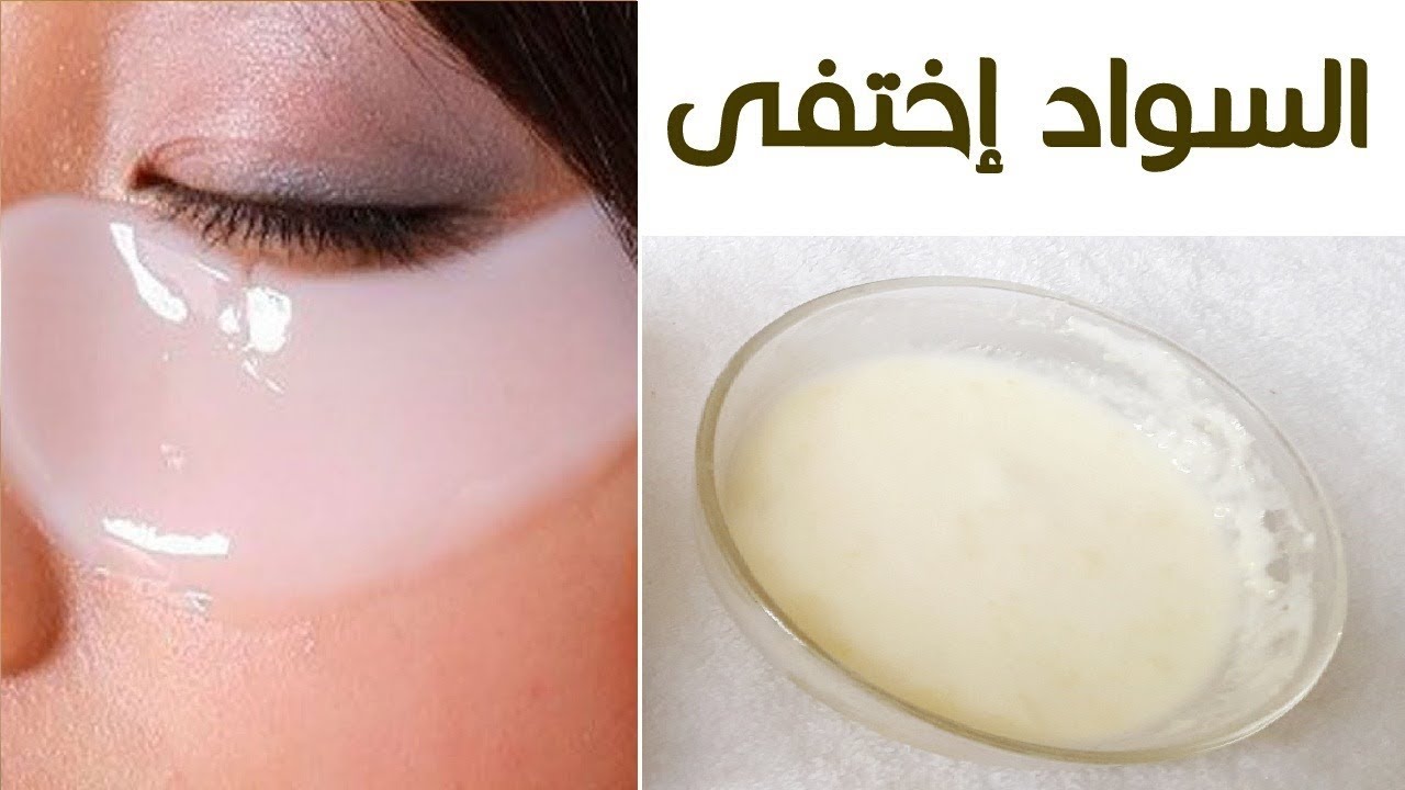 ثلاث وصفات منزلية للتخلص م الهالات السوداء تحت العين 5 ثلاث وصفات منزلية للتخلص م الهالات السوداء تحت العين