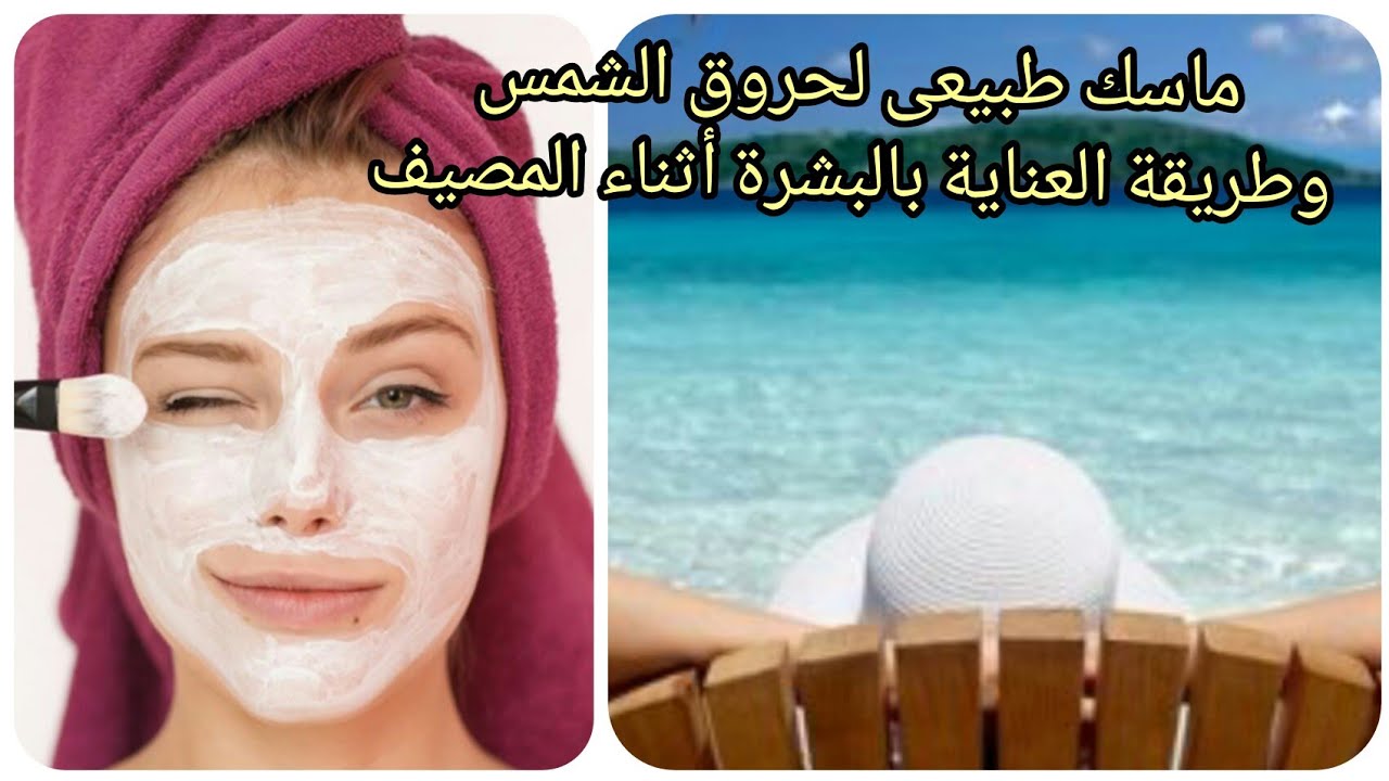 لو رجعت من المصيف .. كيف تتخلص من حروق الشمس بسرعة؟ وصفات طبيعية من المنزل