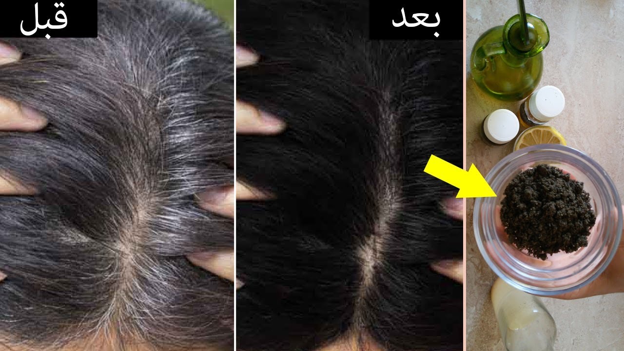 التخلص من الشعر الابيض بوصفات طبيعية والنتيجة فورية 2 التخلص من الشعر الابيض بوصفات طبيعية والنتيجة فورية