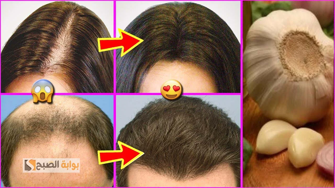 لو شعرك خفيف خالص .. زيوت طبيعية تقضي على مشاكل الشعر الخفيف وتحل مشكلة الساقط وتزود سمكه