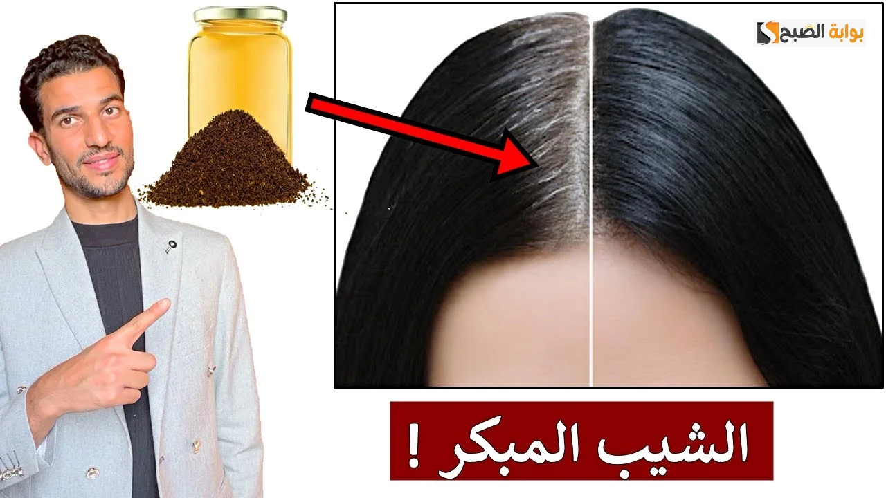وداعاً للشيب المبكر مع وصفات التخلص من الشعر الأبيض نهائيا مجربة 100% وتحدي 2 وداعاً للشيب المبكر مع وصفات التخلص من الشعر الأبيض نهائيا مجربة 100% وتحدي