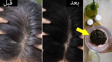 التخلص من الشعر الابيض