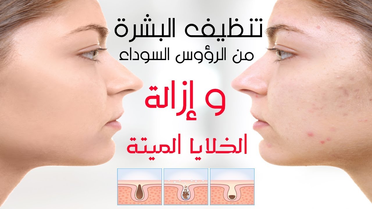 وصفة تقشير البشرة وإزالة الجلد الميت والرؤوس السوداء وتوحيد لون الوجه 2 وصفة تقشير البشرة وإزالة الجلد الميت والرؤوس السوداء وتوحيد لون الوجه