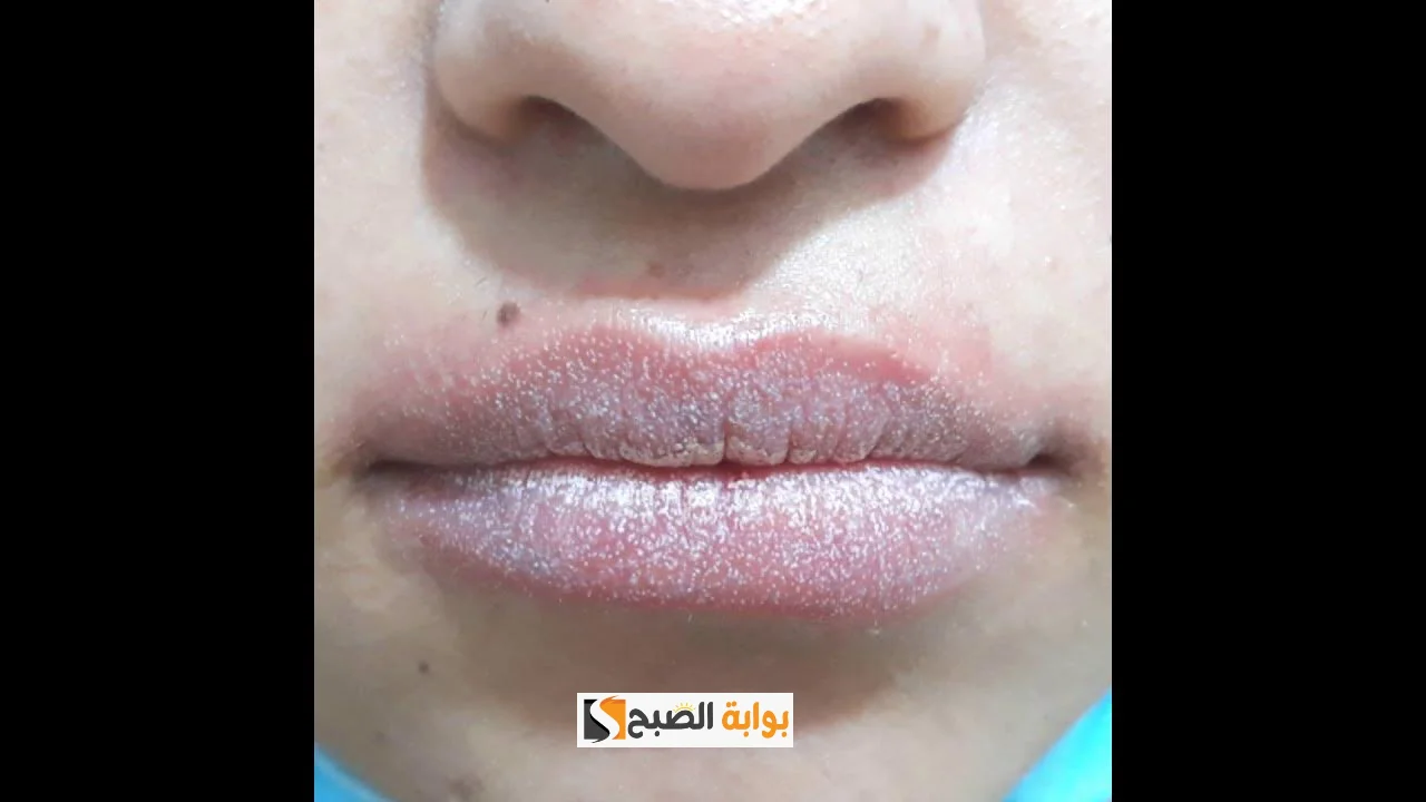 عشان تكوني دايما متألقة .. وصفات طبيعية لشفاه نضرة ووردية “منها زيت جوز الهند والعسل”