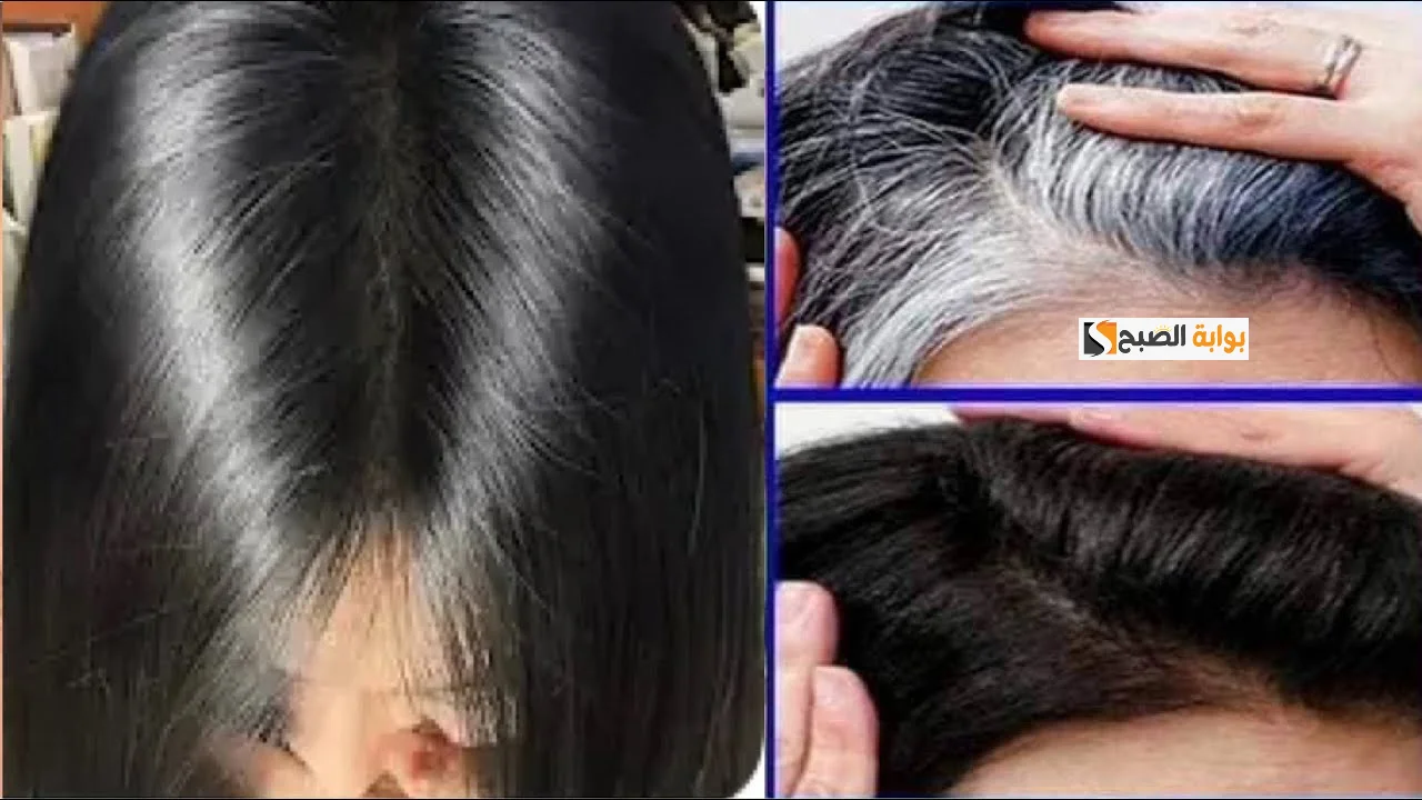 بموزة واحدة تخلصي نهائيا من الشيب حتى لو كان الشعر كله ابيض والنتيجة من اول استعمال 5 بموزة واحدة تخلصي نهائيا من الشيب حتى لو كان الشعر كله ابيض والنتيجة من اول استعمال