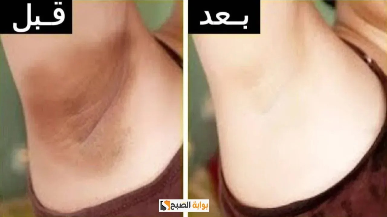 وصفات طبيعيه لتفتيح الأماكن الحساسة جربيها الآن وقولي وداعا للإحراج