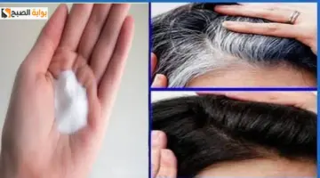 وصفة الملح للقضاء على الشعر الأبيض
