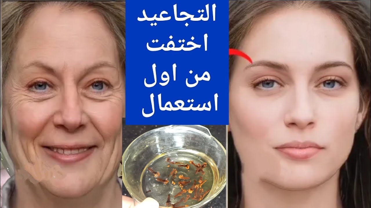 هيخليكي قمر 14.. أفضل زيت للوجه يزيل التجاعيد والترهلات ويشد البشرة بطريقة طبيعية بشرتك هتنور