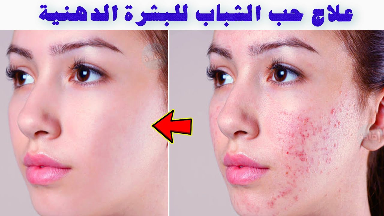 للعناية بالبشرة..إليك 3 وصفات مختلفة بنتائج مذهلة