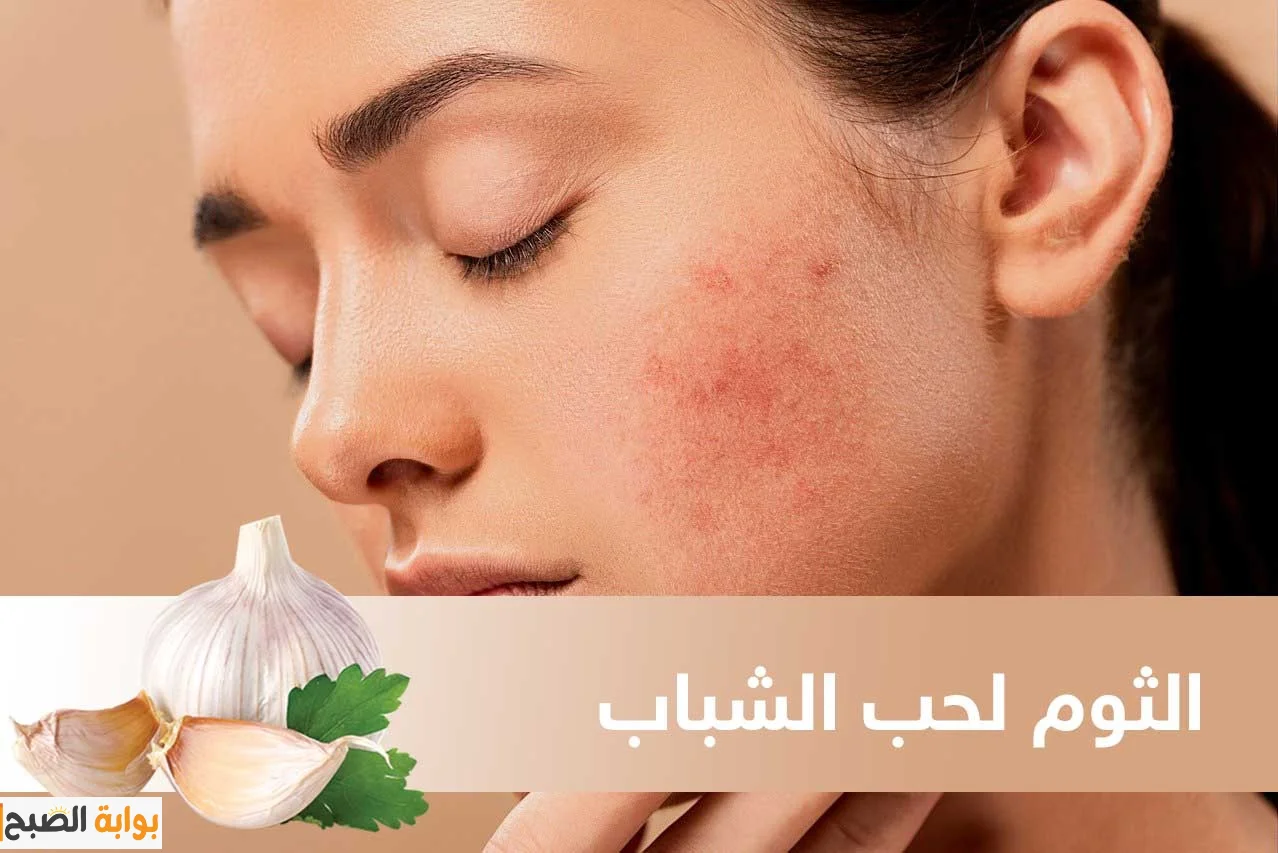 كما لم تعرفها من قبل.. ماسكات الثوم للبشرة للتخلص من حب الشباب وتقضي على الشيخوخة
