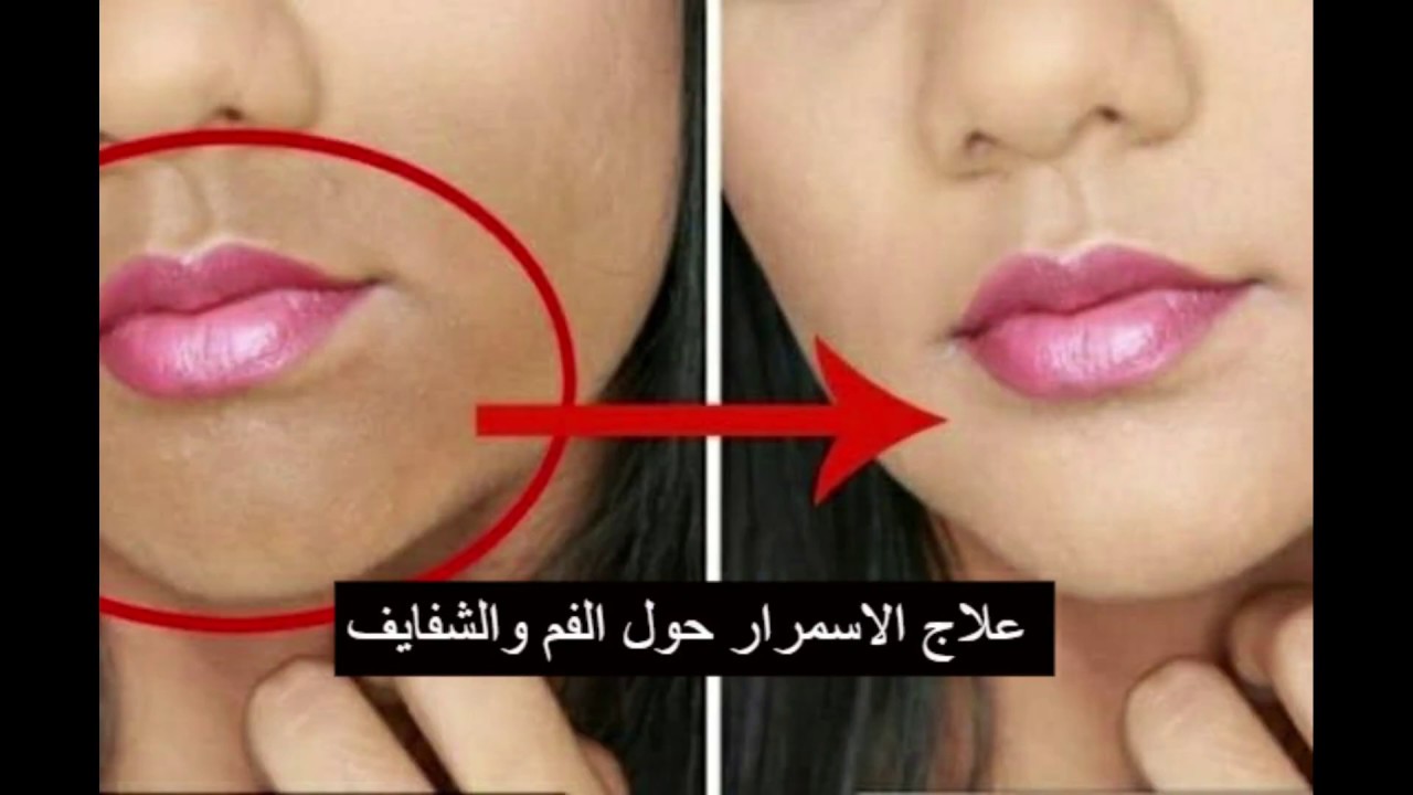 طرق التخلص من الاسمرار حول الفم نهائيا بطريقة طبيعية من أول استعمال