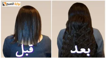 تطويل الشعر وزيادة كثافته