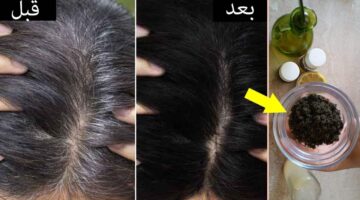 طرق التخلص من الشعر الأبيض