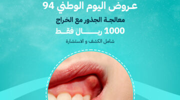 عروض اليوم الوطني الاسنان ج 1280x720 1