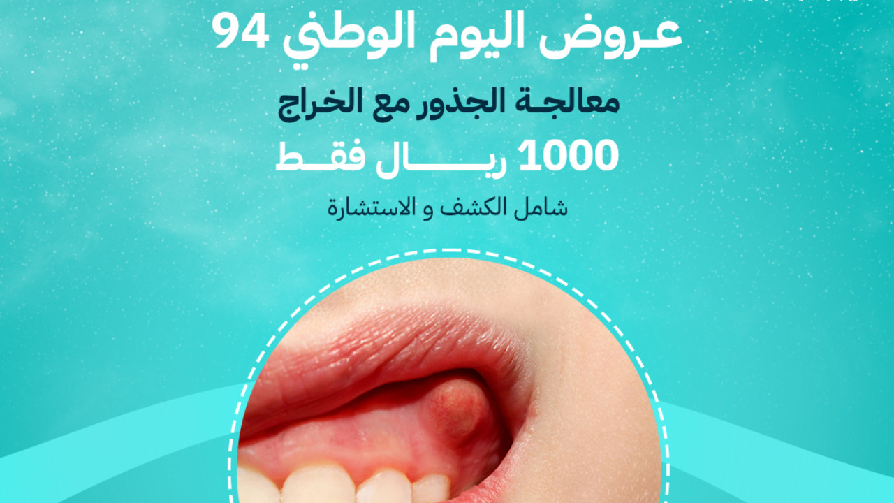 عروض اليوم الوطني اسنان 94 تنظيف وتببيض وإزالة الجير وتركيبات وكشف مجاني لدى بعض مراكز الاسنان 5 عروض اليوم الوطني اسنان 94 تنظيف وتببيض وإزالة الجير وتركيبات وكشف مجاني لدى بعض مراكز الاسنان