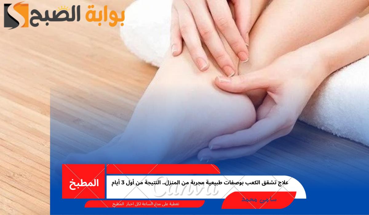 علاج تشقق الكعب بوصفات طبيعية مجربة من المنزل.. النتيجة من أول 3 أيام