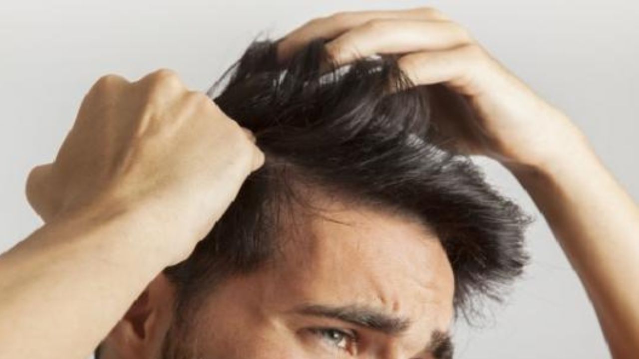 كيفية التخلص من قشرة الرأس بـ 4 وصفات هتساعدك في علاج القشرة من أول مرة والقضاء عليها نهائياً