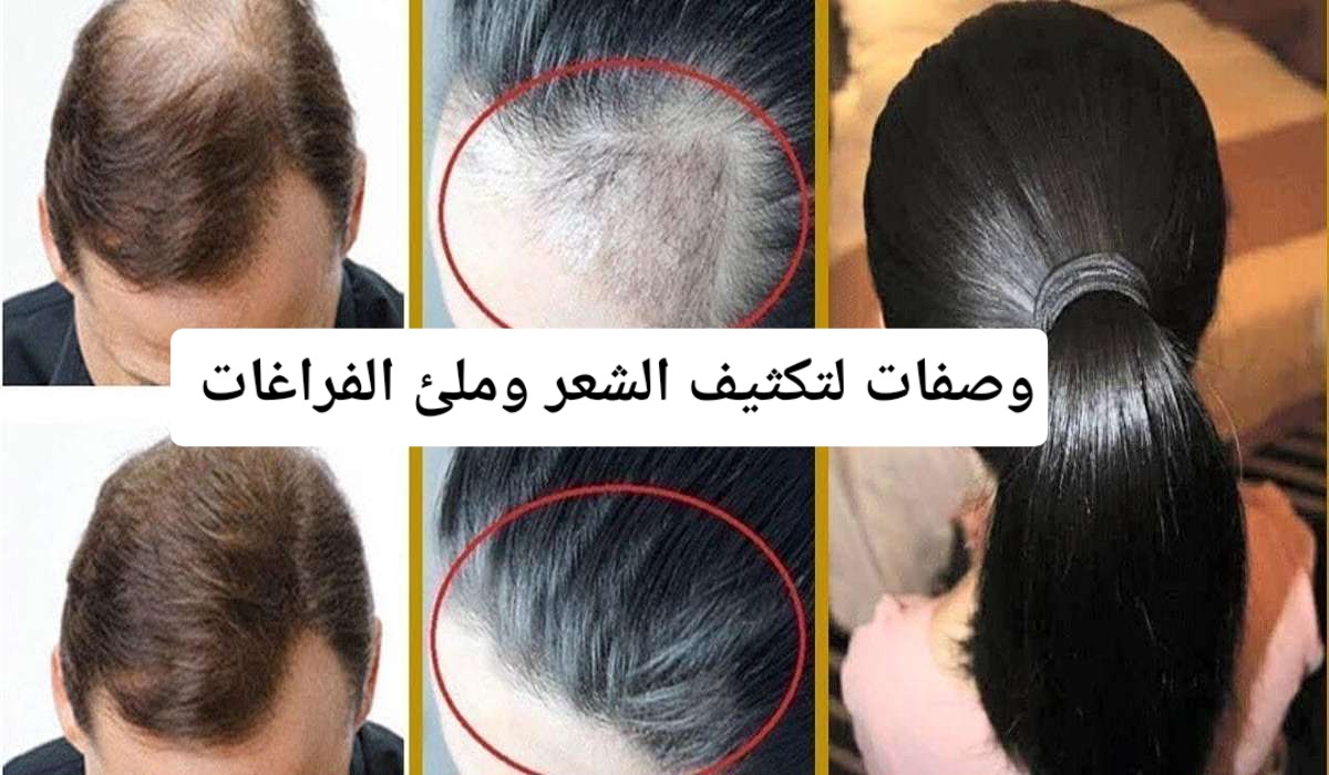 تكثيف وملئ فراغات الشعر بوصفات طبيعية متجربة حل مثالي لتحصلي على شعر كثيف في أسرع وقت