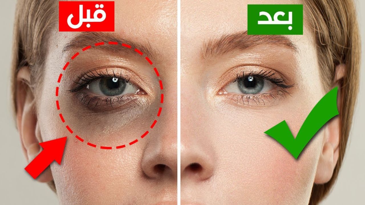 تحت عينك هينور.. ماسكات طبيعية موفرة للتخلص من الهالات السوداء نهائياً