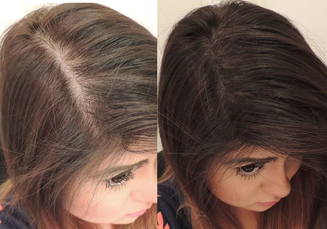 استعيدي كثافة شعرك بخلطات طبيعية لتغذية الشعر وملء الفراغات بمكونات من المنزل