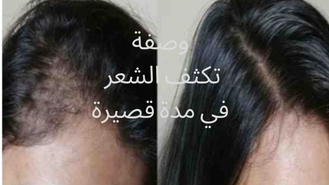 خلي شعرك طويل .. وصفة جهنمية لتطويل الشعر وزيادة كثافته..مش هتصدقي نفسك