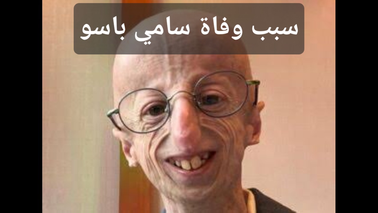 مرض نادر وغريب تسبب في موت سامي باسو تعرف على حقيقة الأمر