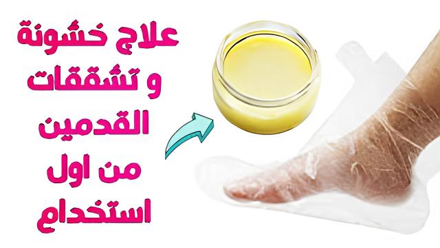 “وصفة جديدة عبقرية” تعالي هاتي شوية زيت زيتون قولي وداعاً لتشققات وخشونه القدمين للأبد