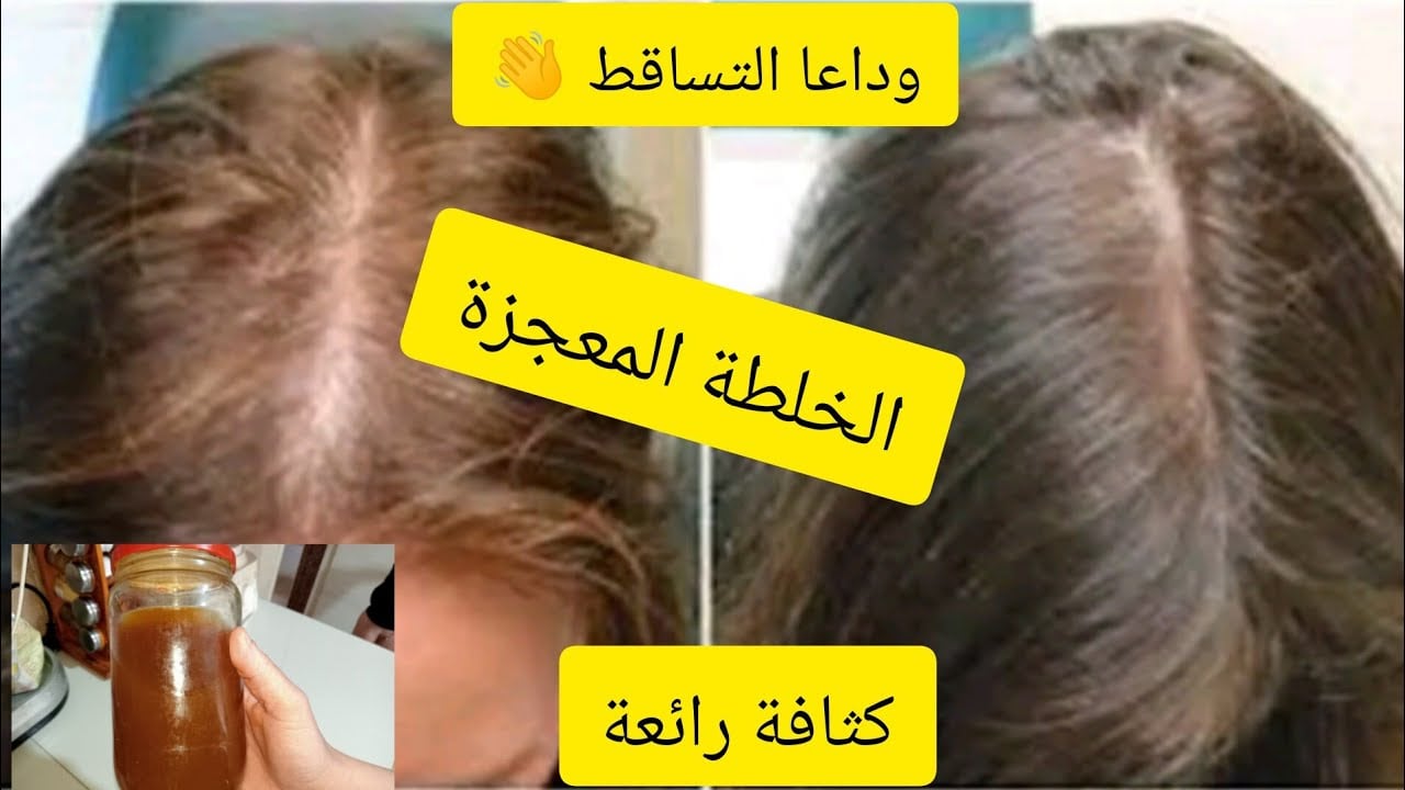متحطيش اكستنشن تاني.. بخاخ الرمان وإكليل الجبل لحل مشكلة الشعر الخفيف وإنبات الفراغات هيجيب من الأخر