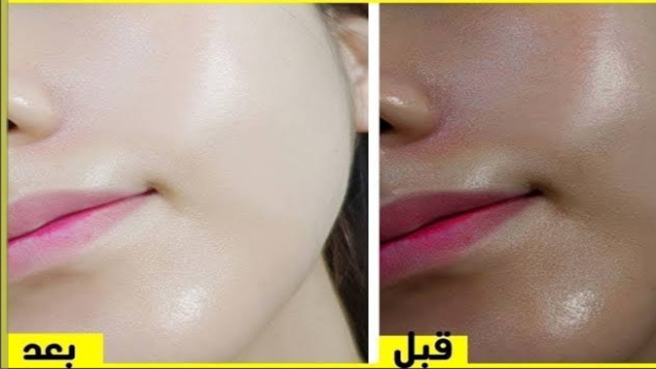 خلطة سورية فعالة لتفتيح الوجه واليدين سريعا آمنه تماماً على البشرة