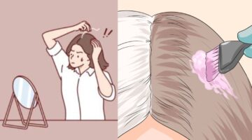 صبغ الشعر الأبيض والتخلص من الشيب
