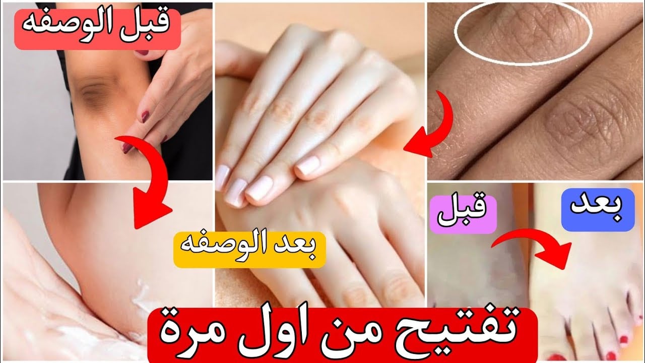 وحدي لون بشرتك.. طريقة عمل وصفة زيت الزيتون والليمون لتفتيح الأيدي هيشيل كل الاسمرار ويخلي ايدك زي القطنة