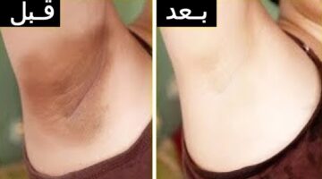 تبييض الجسم1